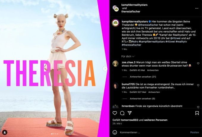 «Hals-und Beinbruch» wünscht «Kampf der Realitystars» Theresia Fischer nach der Beinverlängerung auf Instagram. Theresia Fischer Beinverlängerung