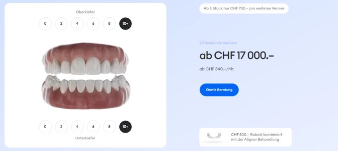Veneers