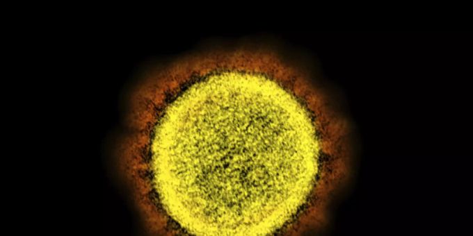 Eine Mikroskopaufnahme des Coronavirus Sars-CoV-2. (Archivbild) Laos nächster Sars CoV 2 Verwandter