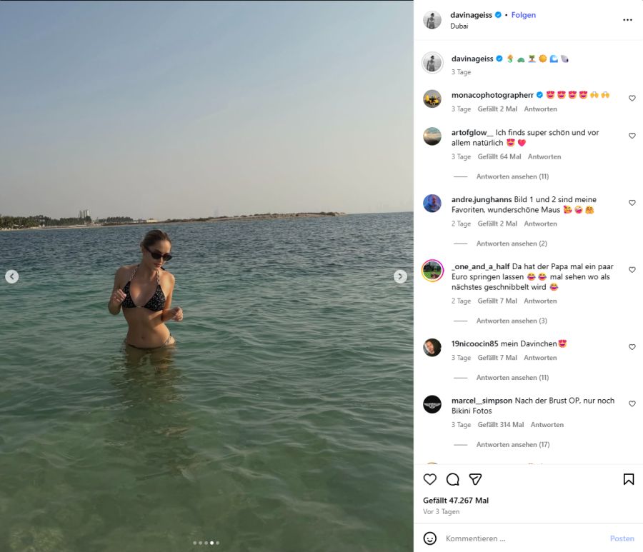 Carmen stimmte schlussendlich zu und begleitete Davina zum Beauty-Doc.