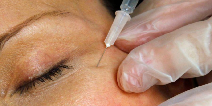 Das Spritzen von Botox ist nicht mehr nur Frauensache. (Symbolbild)