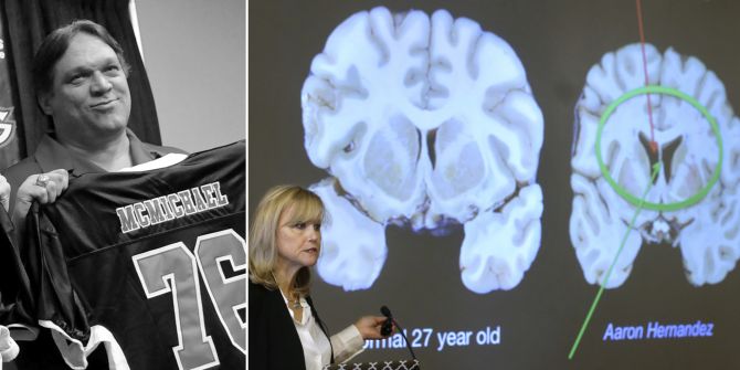 NFL Steve McMichael CTE