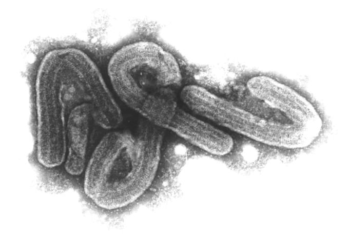 Bislang gibt es keinen zugelassenen Impfstoff gegen das Marburg-Virus. (Symbolbild) Impfstoff Marburg-Virus Virus