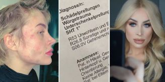 Dsds Star Aline Bachmann Posiert Nach 134 Kilo Diat Im Bikini