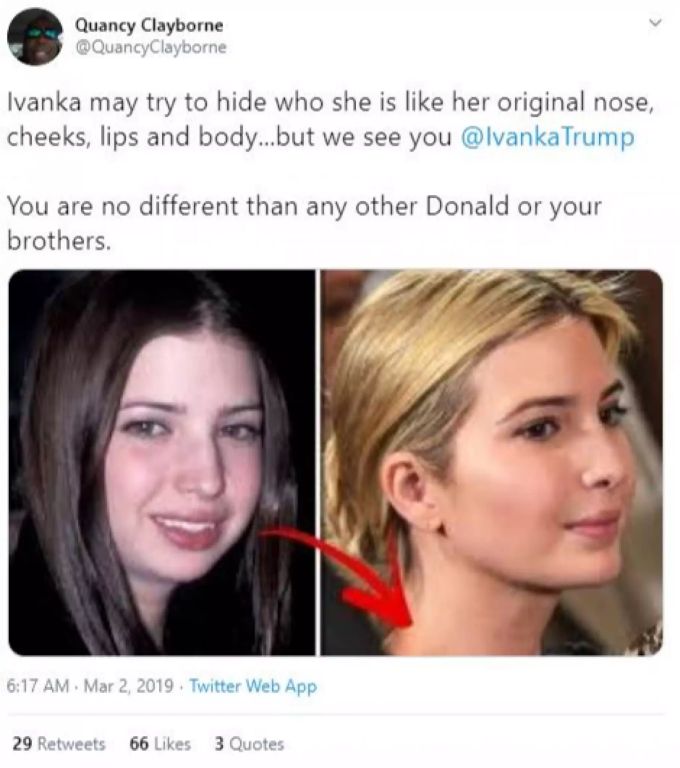 So sah Ivanka Trump vor ihren Beauty-Eingriffen aus. trump