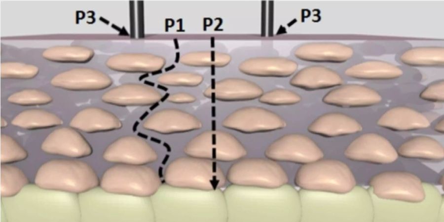 Dampf kann durch verschiedene Wege in die Haut dringen: durch die Zellen (P1), zwischen den Zellen hindurch (P2) oder via Haarfollikel (P3).