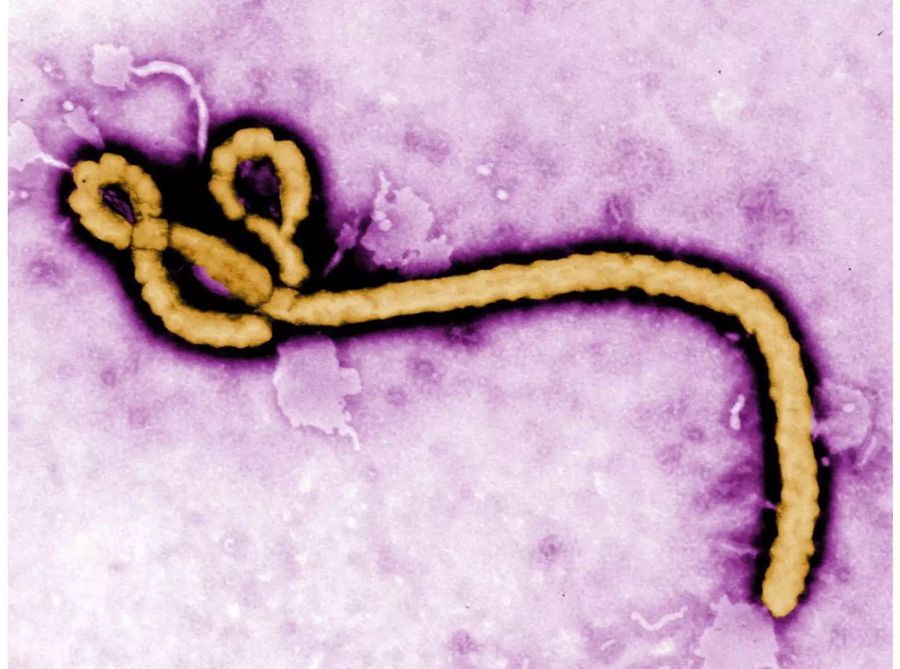 Dieses Bild aus einem Elektronenmikroskop zeigt ein einzelnes Viruspartikel des Ebola-Virus.