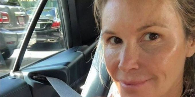 «The Body» machts vor - So herrlich normal sind Stars ohne Make-up