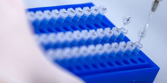 Sequenzierproben helfen bei Untersuchungen von Corona-Varianten. Sequenzierproben helfen bei Untersuchungen von Corona-Varianten.