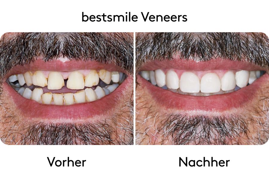 Vorher-Nachher Bilder
