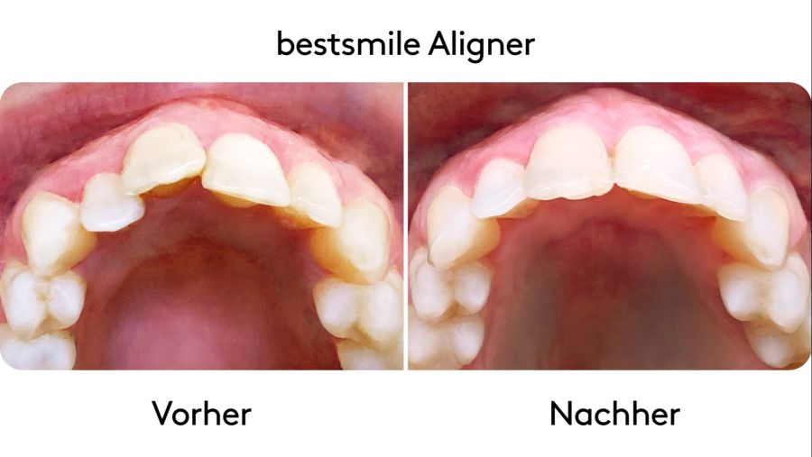 Alles für ein schönes Lächeln.