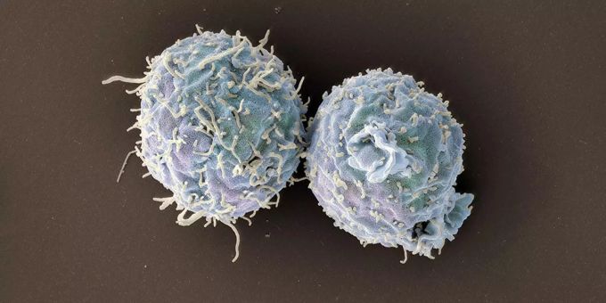T-Zellen des Immunsystems speichern die Zellstrukturen des Erregers. Covid 19 Schnupfen