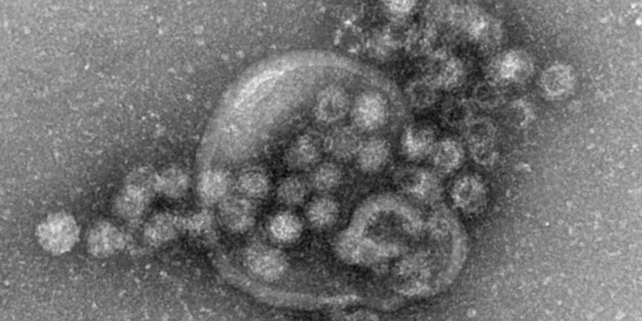 Das hochansteckende Norovirus verursacht einen plötzlich auftretenden, heftigen Brechdurchfall. (Archivbild)