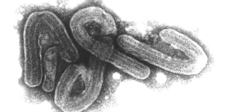 Eine elektronenmikroskopische Aufnahme des Marburg-Virus. (Archivbild)