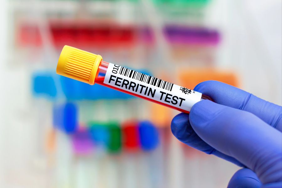 blutprobe ferritin