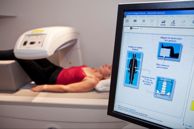 Um aktiv gegen Osteoporose vorzugehen, ist eine Früherkennung sinnvoll. Osteoporose