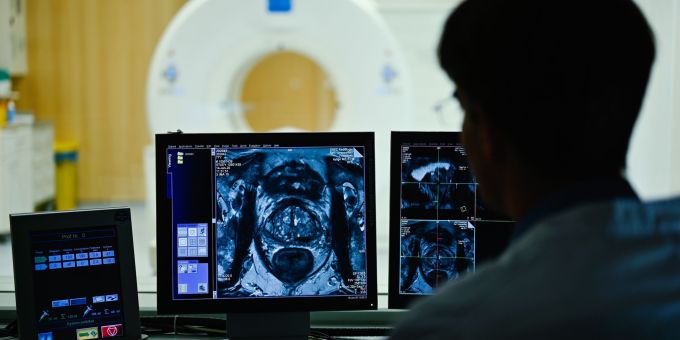 Nach dem Anfangsverdacht: Im Verlauf einer Diagnostik kommen auch bildgebende Verfahren zum Einsatz. (Archivbild) Prostatakarzinom