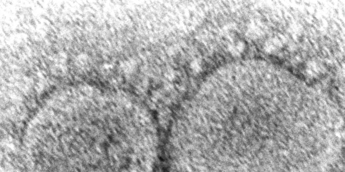 Ein Elektronenmikroskop-Bild von Sars-CoV-2: Eine neue Studie zeigt, dass sich das neue Coronavirus besonders effizient bei Temperaturen vermehrt, wie sie in den oberen Atemwegen herrschen. (Archivbild) Coronavirus