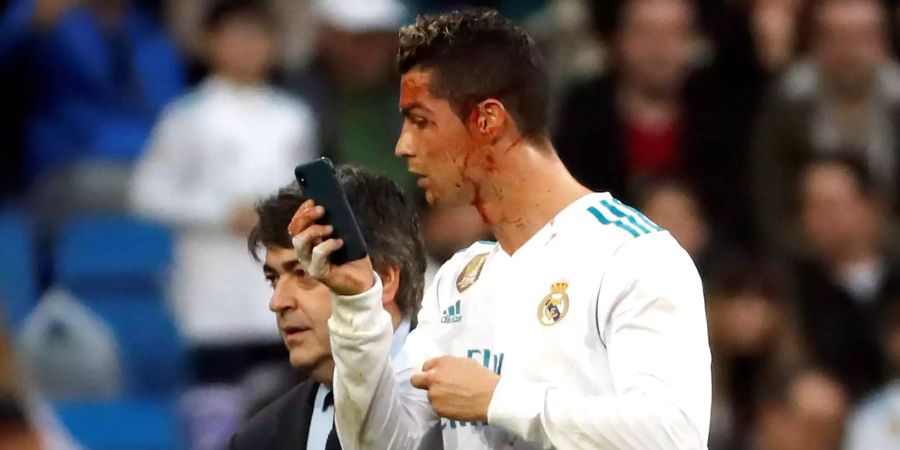 Cristiano Ronaldo bestaunt seine Wunde mit der Smartphone-Kamera.