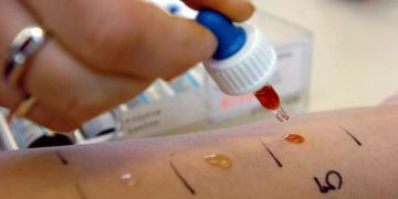 Ein Doktor macht einen Allergietest.