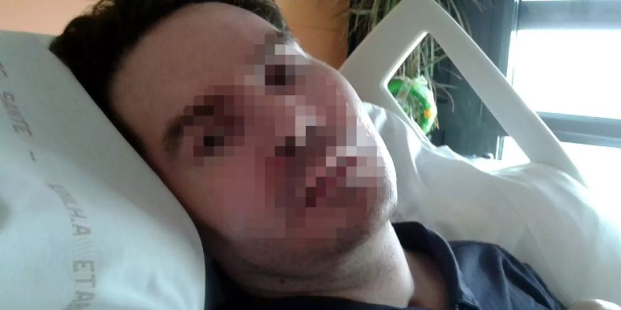 Französischer Koma-Patient Lambert stirbt nach jahrelangem Rechtsstreit um sein Leben