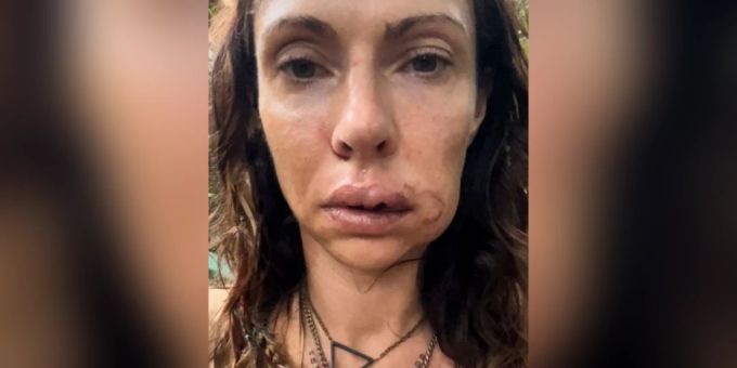 Horror - Dschungelcamp-Jana wurde überfallen und beinahe vergewaltigt