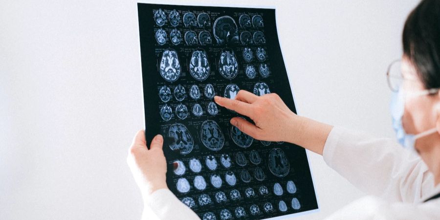 Hirnscans