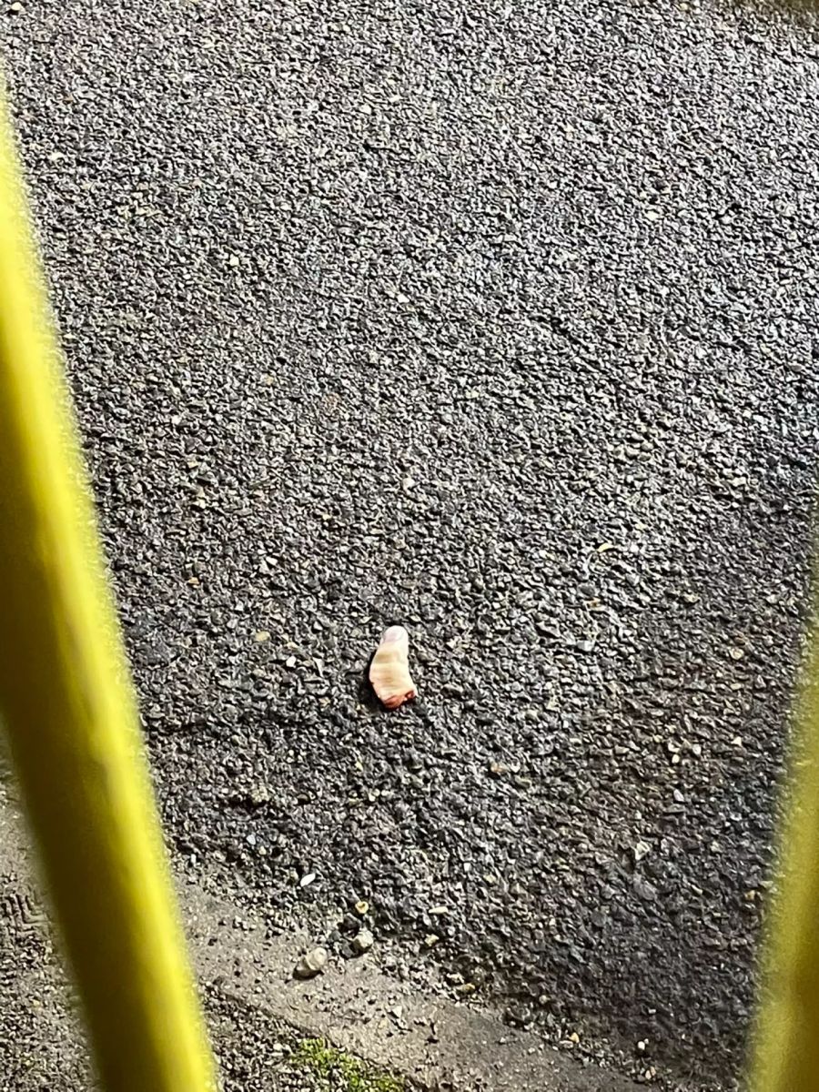 Ein Finger liegt im Gäste-Sektor auf dem Boden.