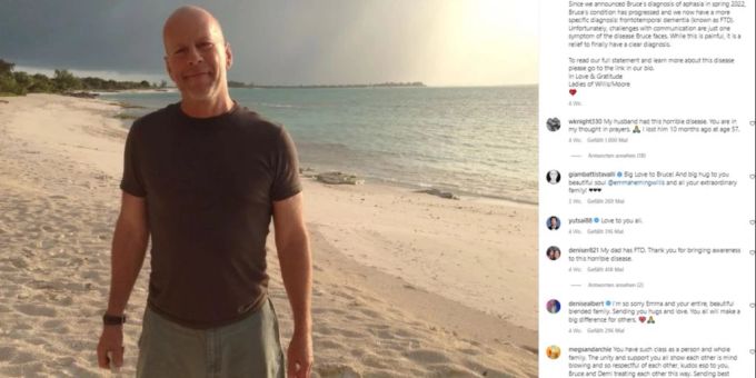 Bruce Willis leidet an Demenz. bruce willis