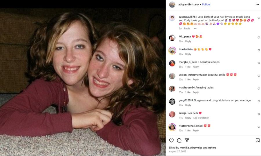 Die Hensels haben zwei Köpfe, aber einen Körper. Jede steuert eine Körperhälfte – Abby rechts, Brittany links.