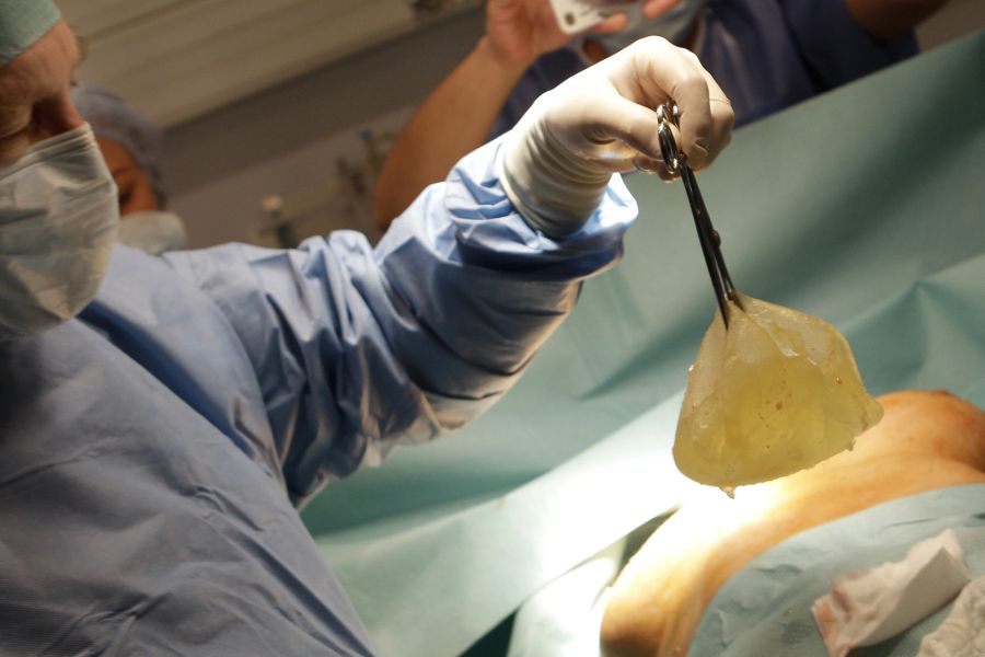 Teilweise müssen sie sogar entfernt werden. (Archivbild)