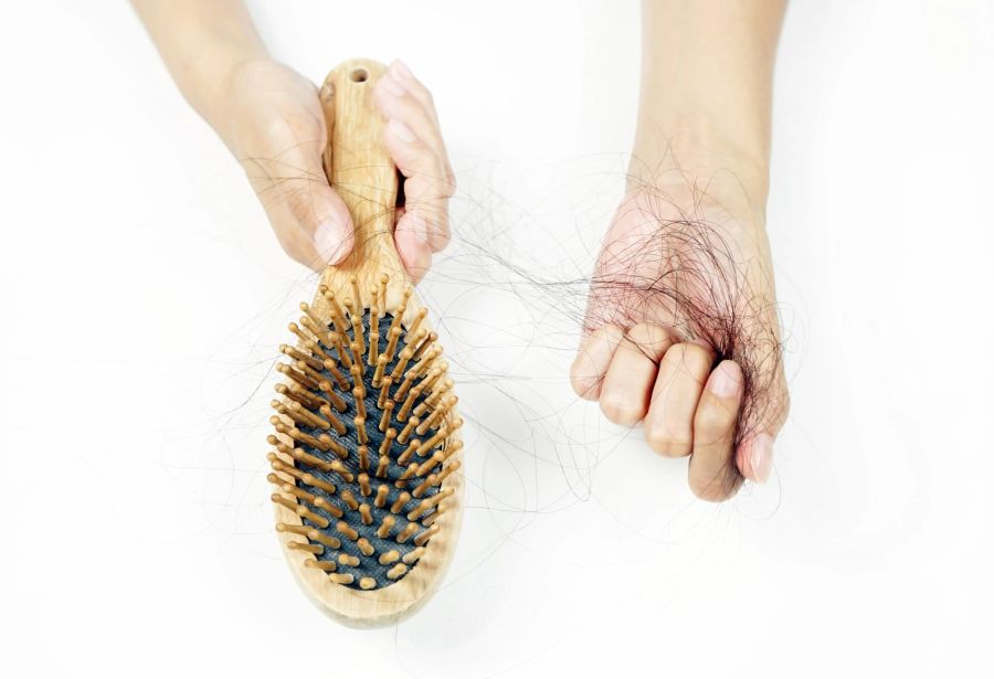 Viele Haare fallen nach dem Kämmen in Haarbürste. Frau hält schwarze Haare in der Hand.