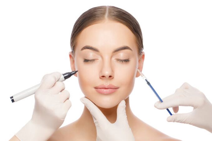 Das «Deep Plane Facelift» liegt laut Chirurgen voll im Trend. Deep Plane Facelift
