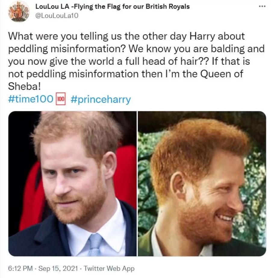 Die Haare von Prinz Harry wirken deutlich voller.