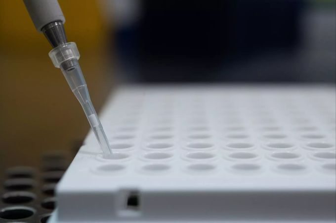 Studie Bauchspeicheldrüse: Coronavirus kann Diabates-ähnliche Symptome verursachen. Studie Bauchspeicheldrüse
