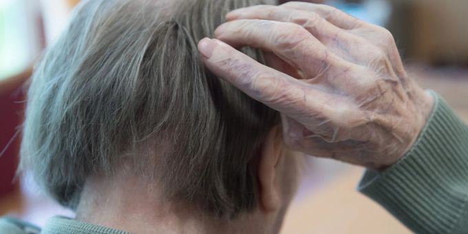Ein neuartiges Antikörper-Medikament verlangsamt einer Studie zufolge das Fortschreiten von Alzheimer. Ein neuartiges Antikörper-Medikament verlangsamt einer Studie zufolge das Fortschreiten von Alzheimer.