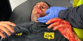 Trainer verletzt! - Steinwurf-Attacke auf Team-Bus von Olympique Lyon Trainer verletzt! - Steinwurf-Attacke auf Team-Bus von Olympique Lyon