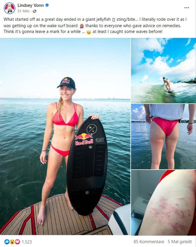 Lindsey Vonn trifft beim Surfen eine Qualle. Lindsey Vonn Qualle Surfen