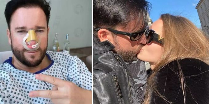 Beauty-OP - Der Wendler kriegt vor Hochzeit neue Nase