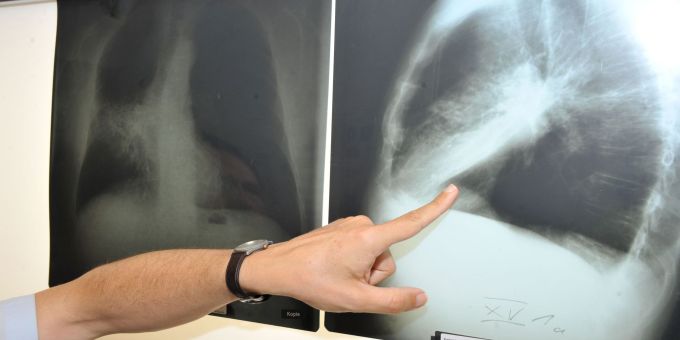 Die Untersuchung dauert nur wenige Minuten und ist schmerzfrei. (Symbolbild) Untersuchung