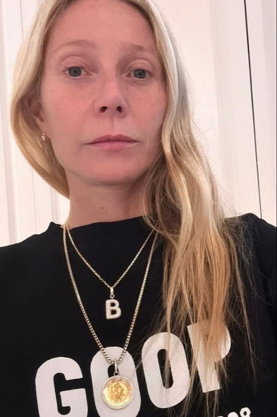 Die 52-Jährige war in der Vergangenheit aber auch schon mal beim Beauty-Doc.