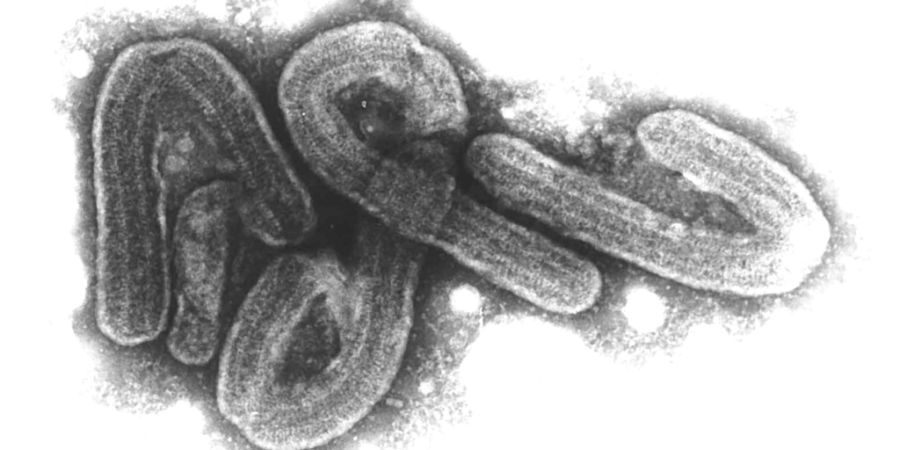 Marbur Virus Mikroskopaufnahme