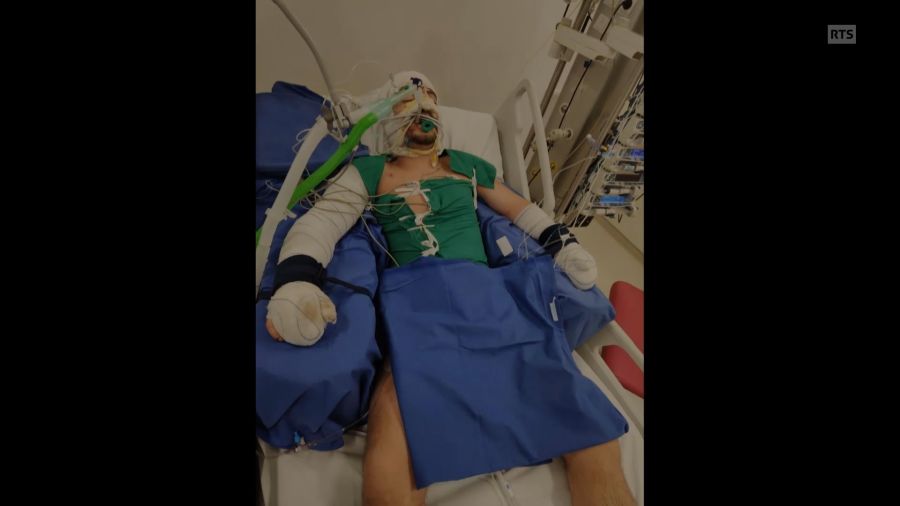 Acht Tage lag der Barkeeper im Koma.