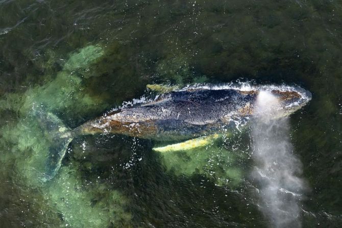 Infektion Gesundheit