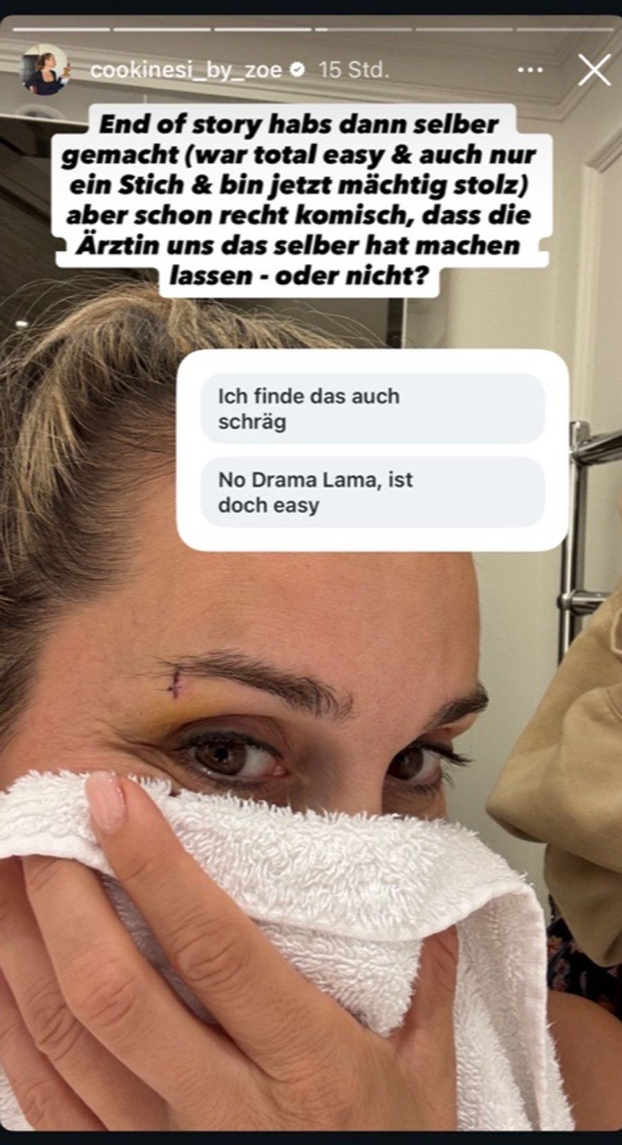 Geschafft: Zoe Torinesi zieht sich den Faden über der Augenbraue schliesslich selbst und zeigt danach die kleine Wunde.