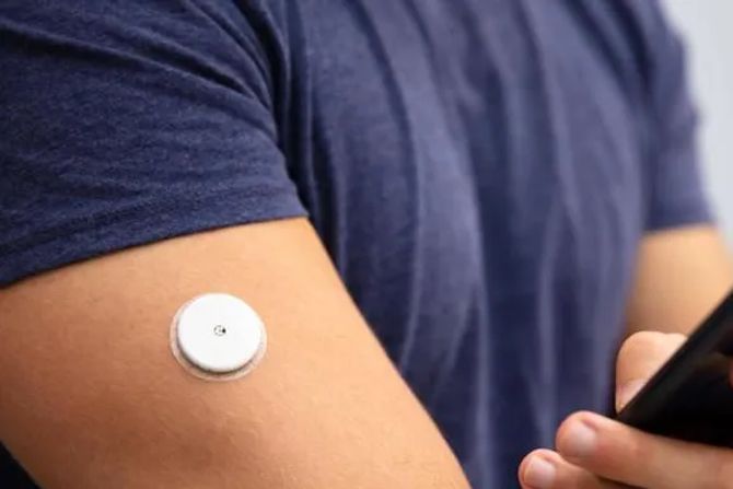 Diabetes Implantat