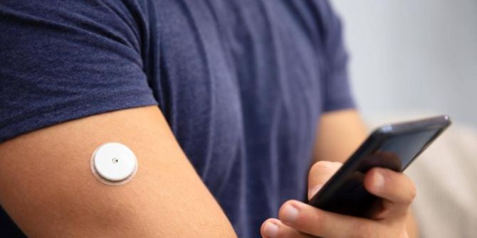 Diabetes Implantat