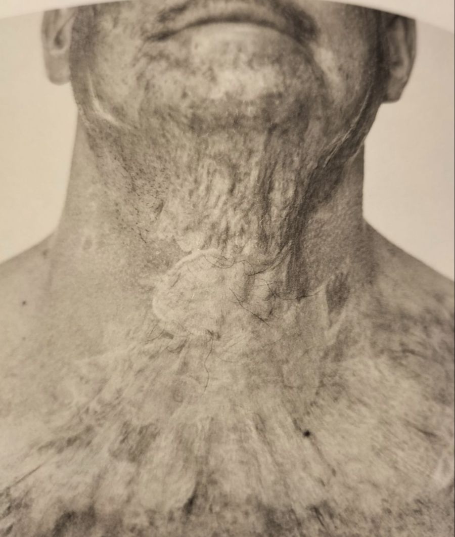 Brandopfer