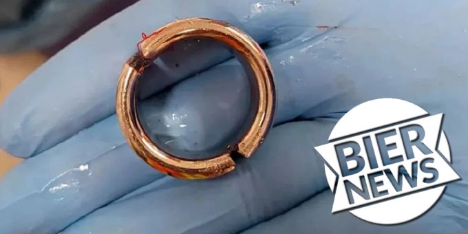 «Hilfeleistung» - Deutsche Feuerwehr muss Mann von Penis-Ring befreien