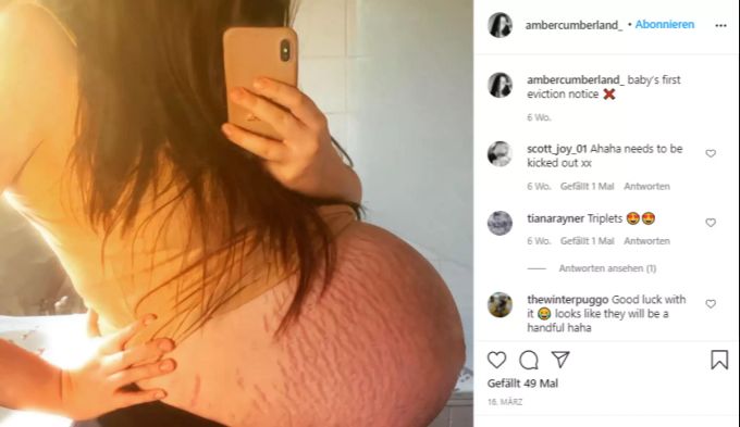 Babybauch